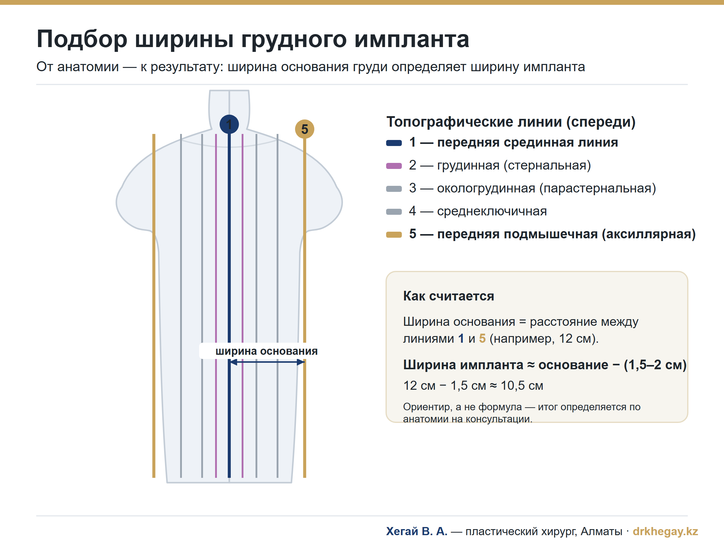 Как я подбираю импланты для увеличения груди